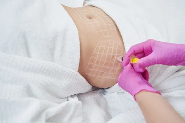 image of fat dissolving injections on love handles to help combat weight gain Northolt