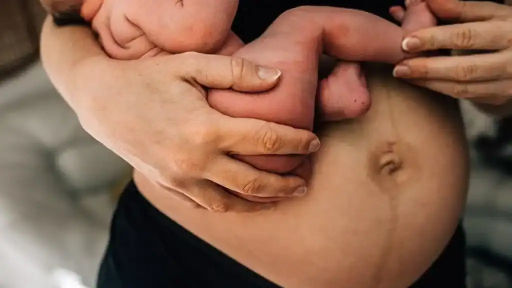 Why Is My Stomach Still Big After Pregnancy Northolt?